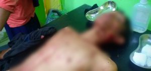 Aniaya Istri, Azhar Dibacok Adik Ipar