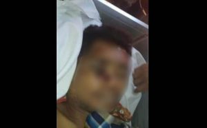 Seorang Pelanggar Lalu Lintas di Lombok Tewas Diduga Dianiaya Oknum Polisi