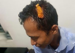 Perampok Bersajam Beraksi di Lotim, Korban Dibacok, Hartanya Dikuras