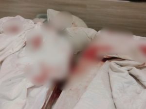 Wanita Muda Ditemukan Bersimbah Darah di Kamar Hotel Usai Terima Tamu