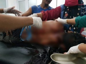 Seorang Siswa SMK di Bima Tewas Ditusuk