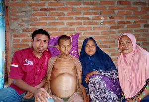 Pemprov NTB bantu warga Desa Punti penderita kanker hati