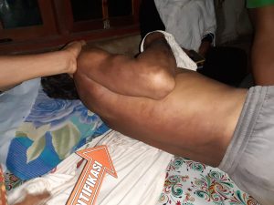 Pemilik kebun jagung tewas tersengat listrik jebakan babi di Dompu