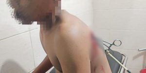 Remaja 15 tahun asal Sori Sakolo dipanah orang tak kenal di Dompu