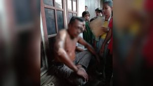 Kesal Disuruh Goreng Ikan, Istri di Bima Siram Minyak Panas ke Suami, Wajah dan Badan Melepuh