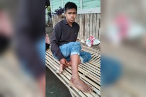 Anjing Liar Kembali Mengamuk, Gigit 3 Warga Sampungu Bima
