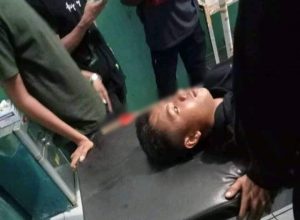 Tersinggung, Pelajar di Sape Bima Panah Temannya, Anak Panah Tertancap di Wajah Korban