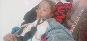 Wanita Penderita Kanker Telinga di Dompu Butuh Uluran Tangan untuk Biaya Pengobatan 