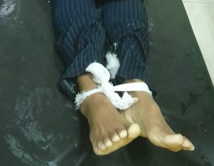 Dua Warga Donggo Disambar Petir, Satu Orang Meninggal Dunia