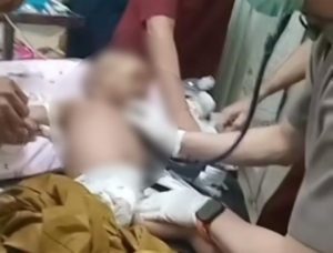 Diduga Disiksa, Bayi di Bima Tewas dengan Luka Gigitan di Badan, Pengasuh Diamankan Polisi