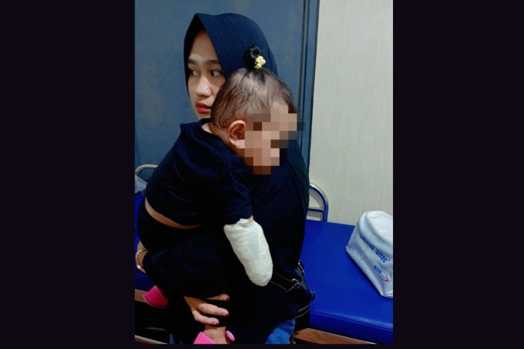 Kepala Puskesmas Bolo Buka Suara soal Kasus Balita Arumi, Bantah Ada Malapraktik