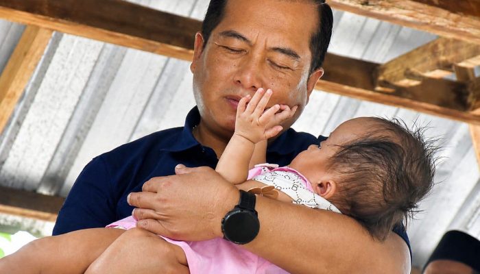 Gubernur Iqbal Blusukan ke Lombok Tengah, Jenguk 2 Penderita Hidrosefalus